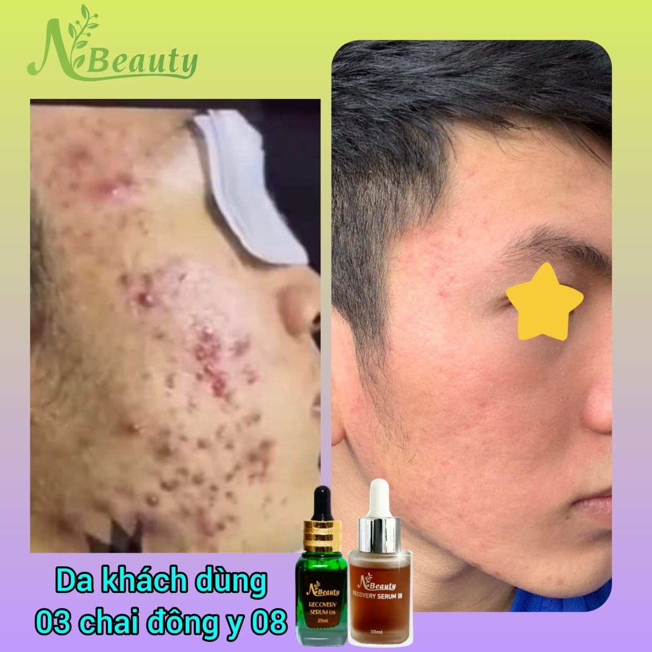 Mỹ Phẩm N Beauty